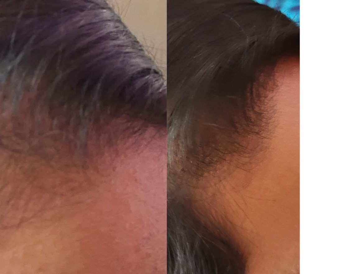 Progress photo after six months of the routine