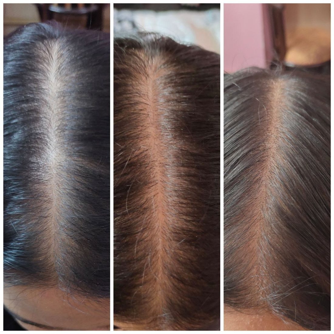 Progress photo after six months of the routine