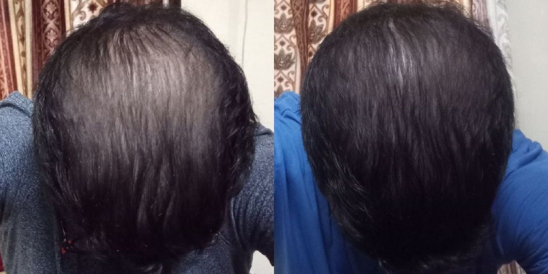 Progress photo after six months of the routine