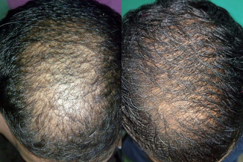 Progress photo after six months of the routine