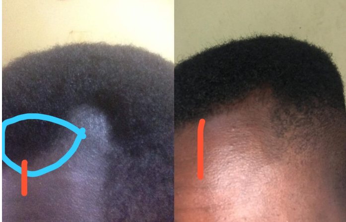 Progress photo after six months of the routine