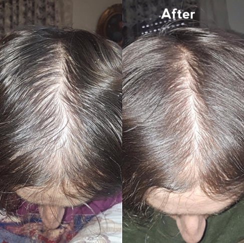 Progress photo after six months of the routine